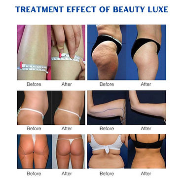 Second image of 8-in-1 Body Contouring & Slimming Treatment